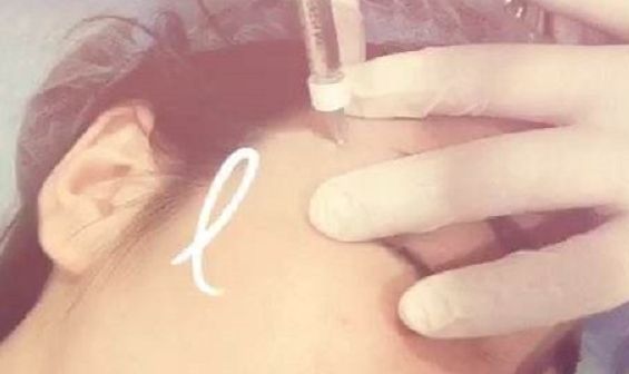 深圳前海地區(qū)哪家整形醫(yī)院比較靠譜？好的深圳整容醫(yī)院有哪些？