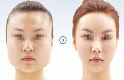 2024年溫州哪家醫(yī)院的整形美容效果最佳？