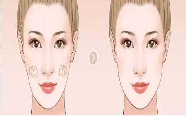 深圳福華整形醫(yī)院的評(píng)價(jià)怎么樣？