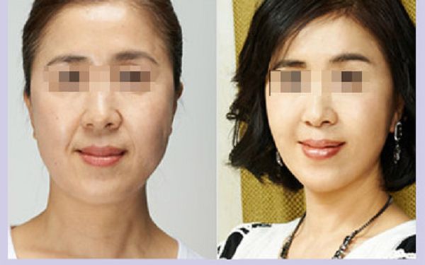 溫州哪家整形醫(yī)院口碑好？排名榜單揭曉
