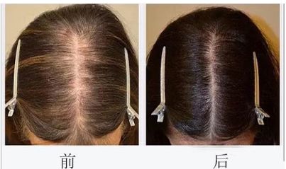 溫州粉范整形醫(yī)院坐診醫(yī)生團(tuán)隊(duì)的技術(shù)和2023服務(wù)水準(zhǔn)綜合解析 溫州粉范整形醫(yī)院坐診醫(yī)生團(tuán)隊(duì)的技術(shù)和2023服務(wù)水準(zhǔn)綜合解析