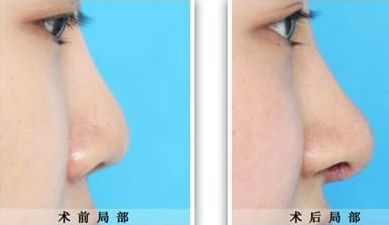 臨汾臻容醫(yī)療美容門診部詳解：技術(shù)水平、服務(wù)項(xiàng)目與價(jià)格清單