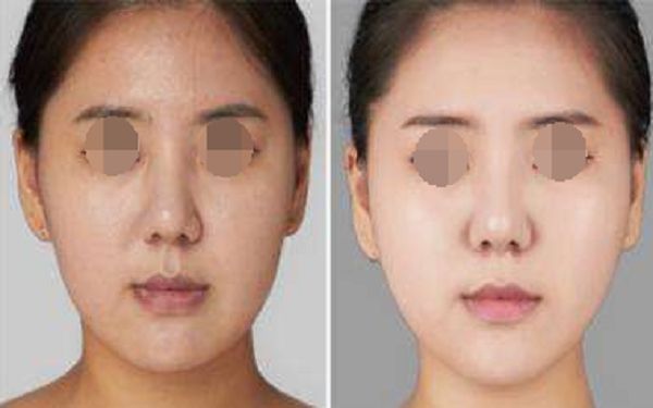 珠海博愛女子醫(yī)院整形外科項(xiàng)目全新推出，項(xiàng)目大揭秘