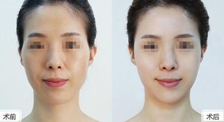 深圳美萊整形醫(yī)院位置介紹，牽手醫(yī)生，搶先體驗(yàn)熱門(mén)項(xiàng)目