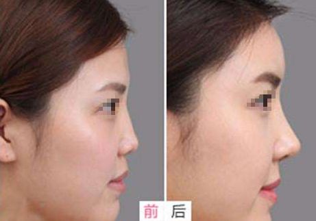相山愛(ài)美爾醫(yī)療美容門(mén)診部，多項(xiàng)特色項(xiàng)目亮相，幫助您煥發(fā)美麗