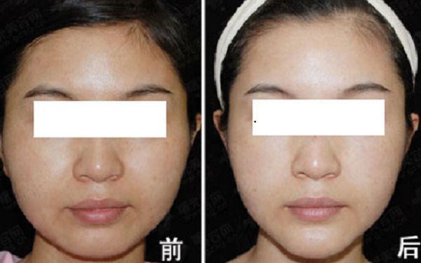 重慶市知名整形美容醫(yī)院榜單出爐！引領(lǐng)時尚潮流的醫(yī)療機構(gòu)盤點
