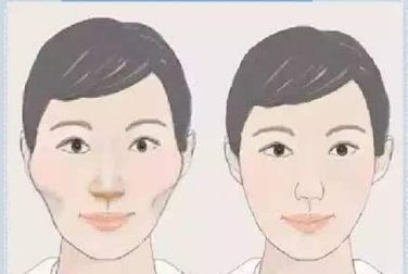 雙眼皮術(shù)后護(hù)理全攻略：埋線(xiàn)和全切有何異同？多久恢復(fù)自然？