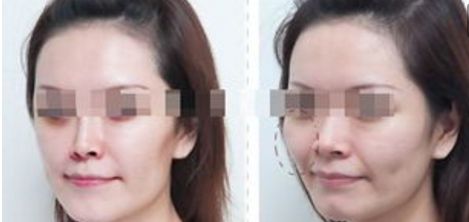 杭州整形美容醫(yī)院排名前六，你值得了解的每一家！