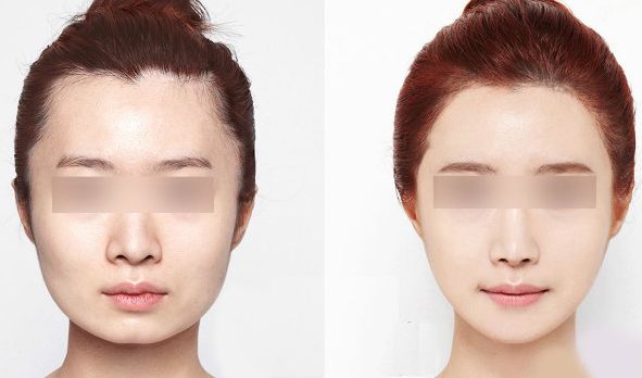 西安藝星醫(yī)療美容醫(yī)院2023年價格一覽：了解醫(yī)療美容服務費用信息，醫(yī)生簡介待查！
