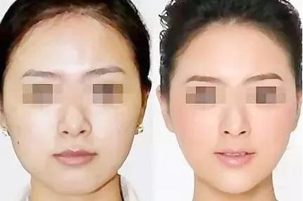 在廣東，如何選擇心儀的醫(yī)美機(jī)構(gòu)？（附醫(yī)院推薦）