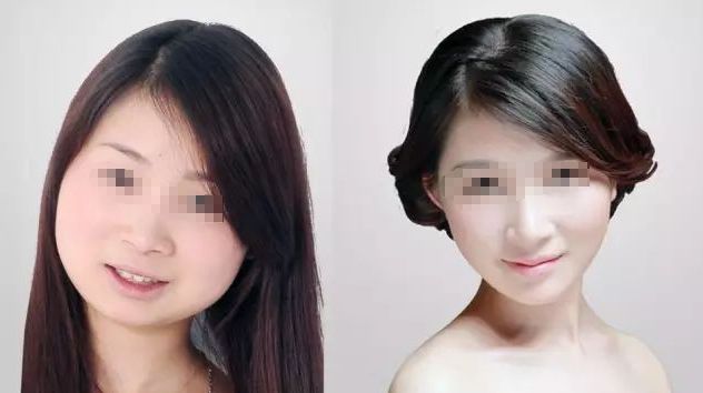 成都藝星何林：打造自然大方雙眼皮，3位顧客口碑爆棚