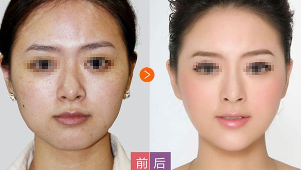 邢臺(tái)博愛高健整容致命嗎？高健整容水平值得信賴！