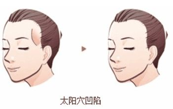 成都整形醫(yī)院排名前十名單整理，銅雀臺(tái)、米蘭柏羽何居首？