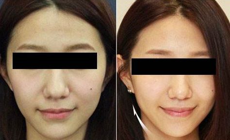 臨沂市哪家整形美容醫(yī)院口碑比較好？