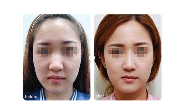 廣州優(yōu)質(zhì)磨骨整形醫(yī)院推薦！TOP10醫(yī)療機(jī)構(gòu)揭秘
