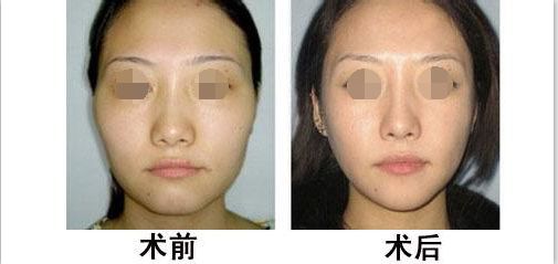 蘭州有哪些專業(yè)整形醫(yī)院值得去？