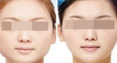 2024大連哪家醫(yī)院吸脂效果最好？這里有前十名匯總！