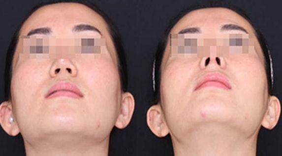 重慶哪家整形醫(yī)院口碑好？專業(yè)整形醫(yī)院推薦匯總