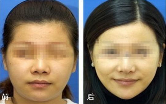 廣東美恩整形美容醫(yī)院口碑揭秘：地址、醫(yī)生評價指南