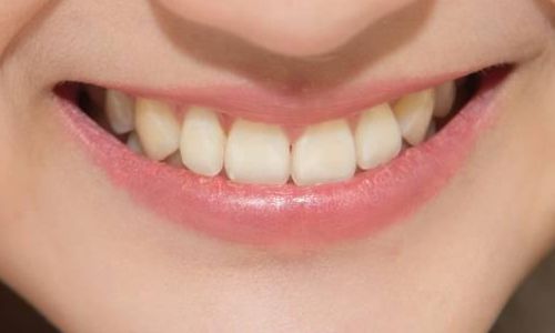 深圳哪里可以做安全可靠的抽脂手術(shù)？