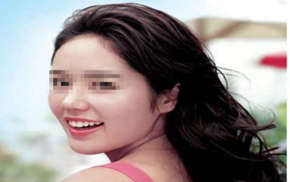 烏魯木齊哪家整形醫(yī)院的口碑比較好？