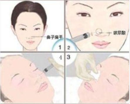 韓美醫(yī)療美容醫(yī)院熱門醫(yī)生與專業(yè)項目介紹