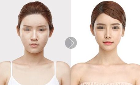 北京植發(fā)醫(yī)院推薦，哪家效果好？