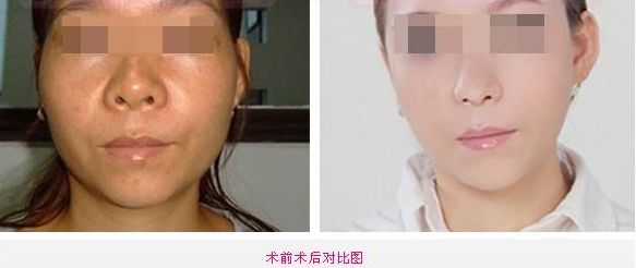 全新整容醫(yī)院推薦！這5家值得你關(guān)注