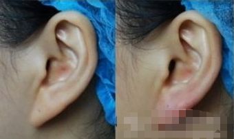 湖州哪家醫(yī)院能有效提升面部外觀？