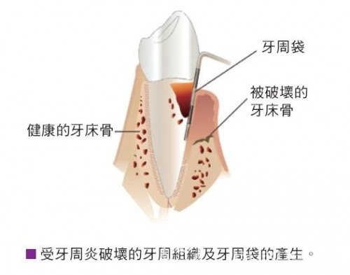 嘉興口周紋嗨體填充醫(yī)生