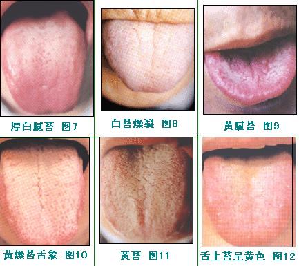 蘭州玻尿酸填充法令紋醫(yī)生