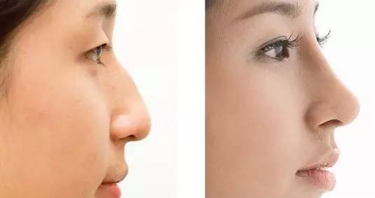 深圳瘦大腿吸脂術醫(yī)生