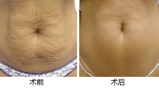 義烏整形醫(yī)院優(yōu)選TOP5，專業(yè)權威推薦，如何做出準確選擇？深入了解為上策