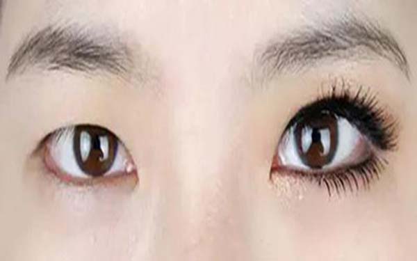 樂山整形醫(yī)院推薦：達芬奇與西嬋，你更喜歡哪一個？獲取比較結(jié)果！