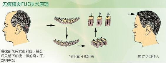 東莞最佳口腔診所盤點：解決牙齒健康問題的最佳選擇！