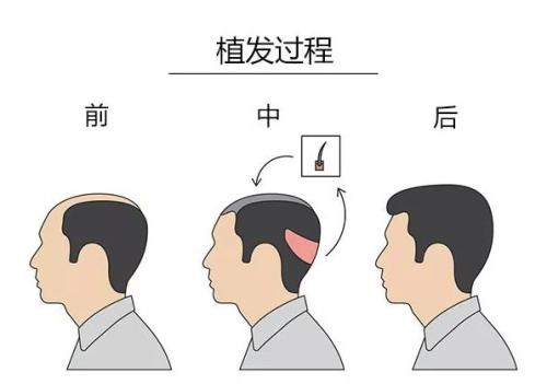 【獨(dú)家】年度最佳整形醫(yī)院盤(pán)點(diǎn)！2023連續(xù)六年蟬聯(lián)冠軍，匠心品質(zhì)贏得無(wú)數(shù)口碑推薦！
