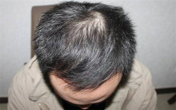 南昌三甲醫(yī)院全面盤點(diǎn)：專業(yè)美容整形醫(yī)院推薦，趕緊了解一下！