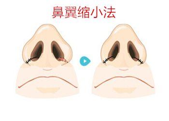 北京十大優(yōu)質(zhì)口腔醫(yī)院推薦，佳美第三醫(yī)院備受贊譽(yù)！中諾榜之精選參考