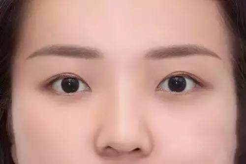 昆明射頻微針去生長(zhǎng)紋醫(yī)生