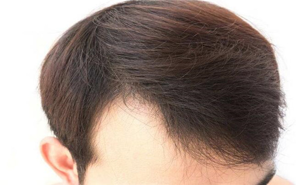 廣州整形醫(yī)院綜合指南：不可錯(cuò)過(guò)的醫(yī)美中心全解析！