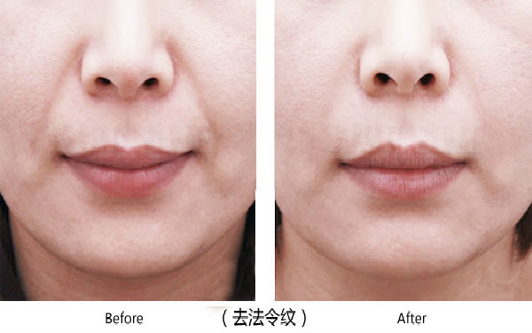 寶雞整容醫(yī)院大整頂級優(yōu)質(zhì)匯總！高一生對決愛容妍_絕對實力的對比震撼