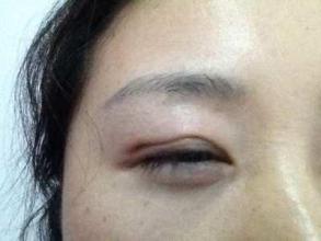 廣州隆鼻手術(shù)：挑選最好的醫(yī)生，口碑盤點！是否有你最滿意的專家？