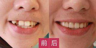 哪家醫(yī)院適合進(jìn)行磨骨手術(shù)？江城和美立方廣受網(wǎng)友推崇！