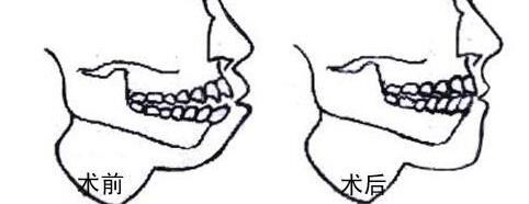 太原祛疤醫(yī)院推薦:多家專業(yè)機(jī)構(gòu)為您帶來有效祛疤方案! 太原祛疤醫(yī)院推薦:多家專業(yè)機(jī)構(gòu)為您帶來有效祛疤方案!