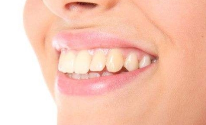 威海整形醫(yī)院評(píng)價(jià)推薦：當(dāng)?shù)赜锌诮员腡op名單，歡迎考慮威海整形之旅！