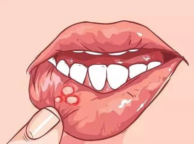 廣州五家專業(yè)眼袋醫(yī)院匯總，重磅推薦中家醫(yī)、華美等！