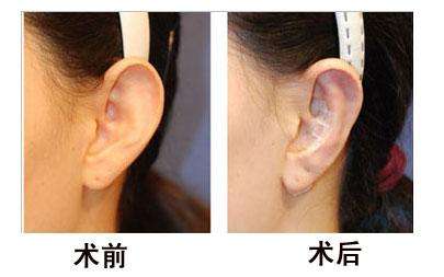 杭州首家頂級(jí)玻尿酸修復(fù)醫(yī)院：珠兒美容醫(yī)院實(shí)力獲得廣泛認(rèn)可