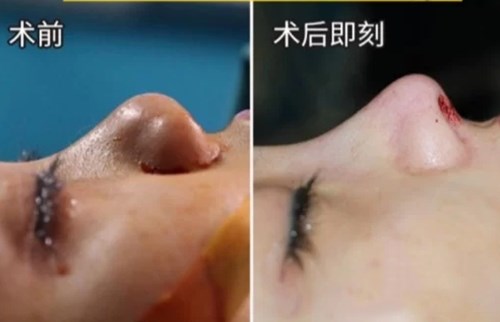 杭州哪家醫(yī)院是面部吸脂的佼佼者？推薦前六強(qiáng)公&私立醫(yī)院，讓您選到心儀的！