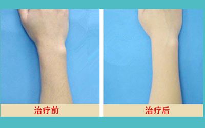 最新發(fā)布！匯總?cè)箩t(yī)院名單，解決牙齒問題待了整整一年