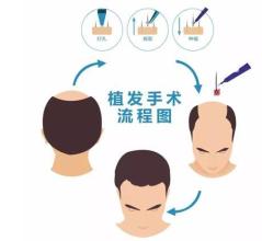 昆明哪家隆鼻醫(yī)院比較靠譜？【10所信譽極高的醫(yī)療機構(gòu)】